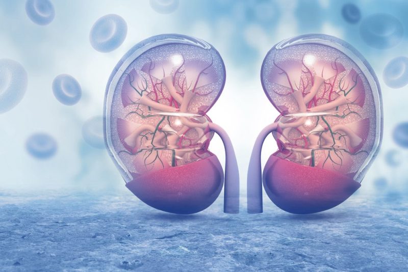 Kidney failure Kidney failure